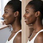 Jawline V-Lifting Kinesiology Night-Patch (10pcs)