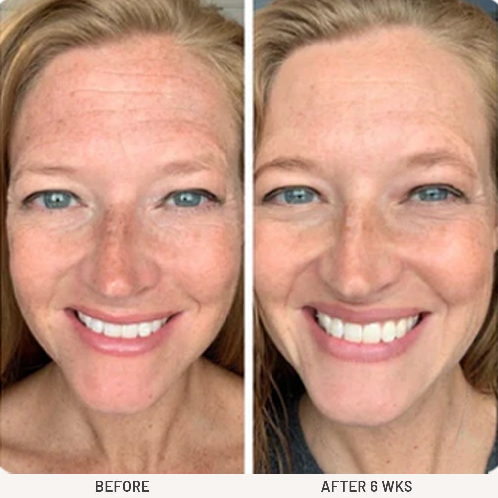 Forehead-Smoothing Kinesiology Night-Patch (20pcs)