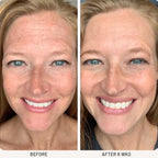 Forehead-Smoothing Kinesiology Night-Patch (20pcs)